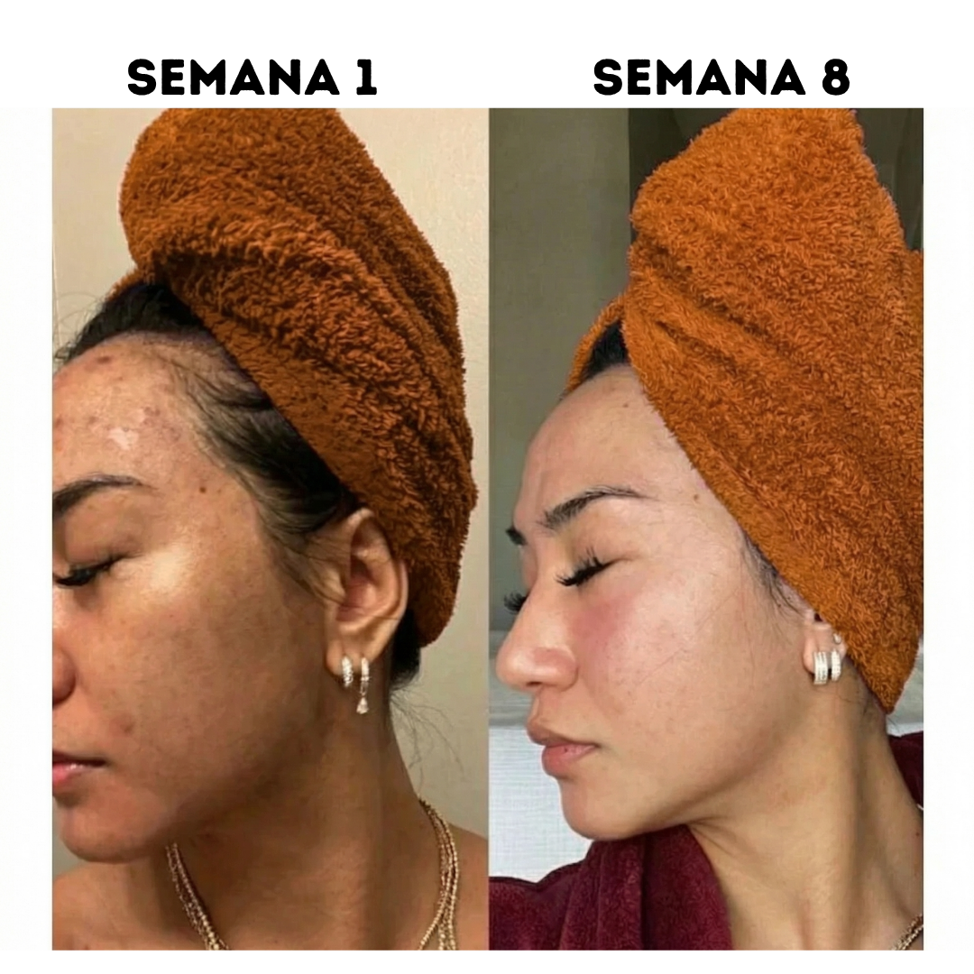 Elevair Honey Glow Bar